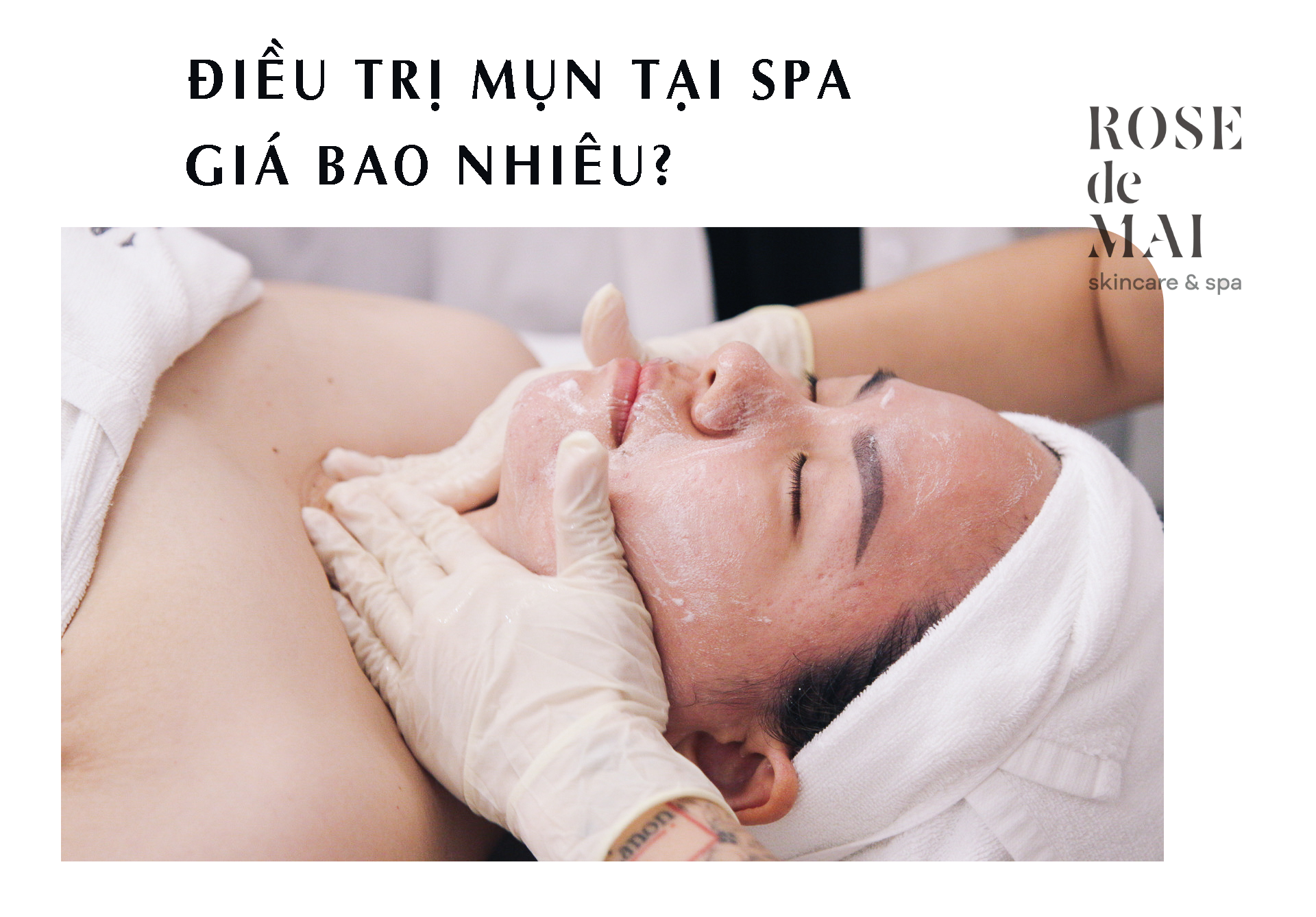 Điều trị mụn tại spa gia bao nhiêu